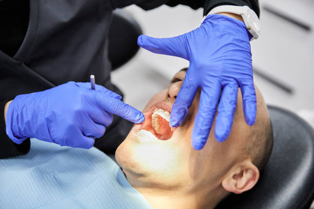 Best Emergency Tooth Extraction in Swede Heaven, WA